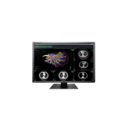 EIZO RadiForce RX660 LED display 76,2 cm (30") 3280 x 2048 pixels WQSXGA Noir, Blanc (RX660-BK)
