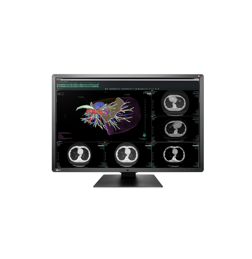 EIZO RadiForce RX660 LED display 76,2 cm (30") 3280 x 2048 pixels WQSXGA Noir, Blanc (RX660-BK)