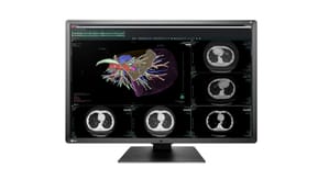 EIZO RadiForce RX660 LED display 76,2 cm (30") 3280 x 2048 pixels WQSXGA Noir, Blanc (RX660-BK)