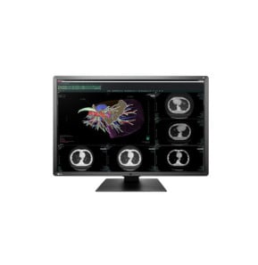 EIZO RadiForce RX660 LED display 76,2 cm (30") 3280 x 2048 pixels WQSXGA Noir, Blanc (RX660-BK)