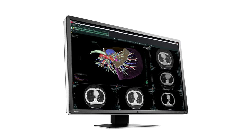 EIZO RadiForce RX660 LED display 76,2 cm (30") 3280 x 2048 pixels WQSXGA Noir, Blanc (RX660-BK) — image 3