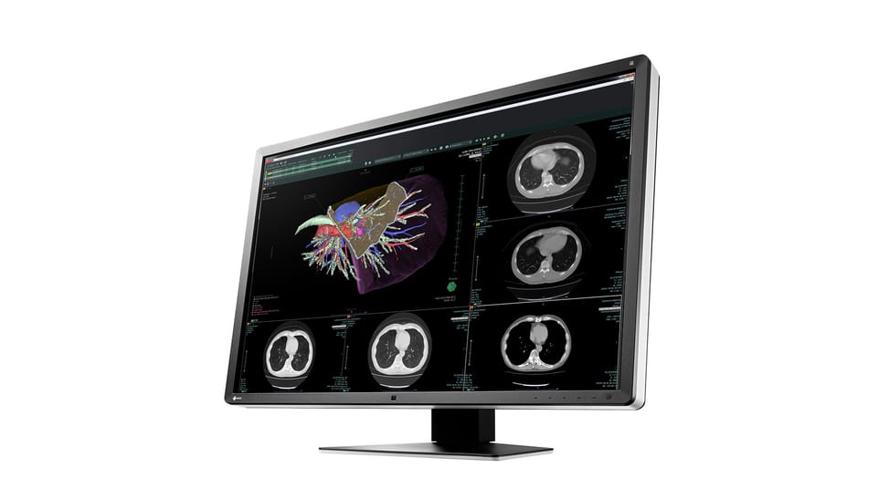 EIZO RadiForce RX660 LED display 76,2 cm (30") 3280 x 2048 pixels WQSXGA Noir, Blanc (RX660-BK) — image 6