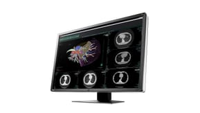 EIZO RadiForce RX660 LED display 76,2 cm (30") 3280 x 2048 pixels WQSXGA Noir, Blanc (RX660-BK) — image 6