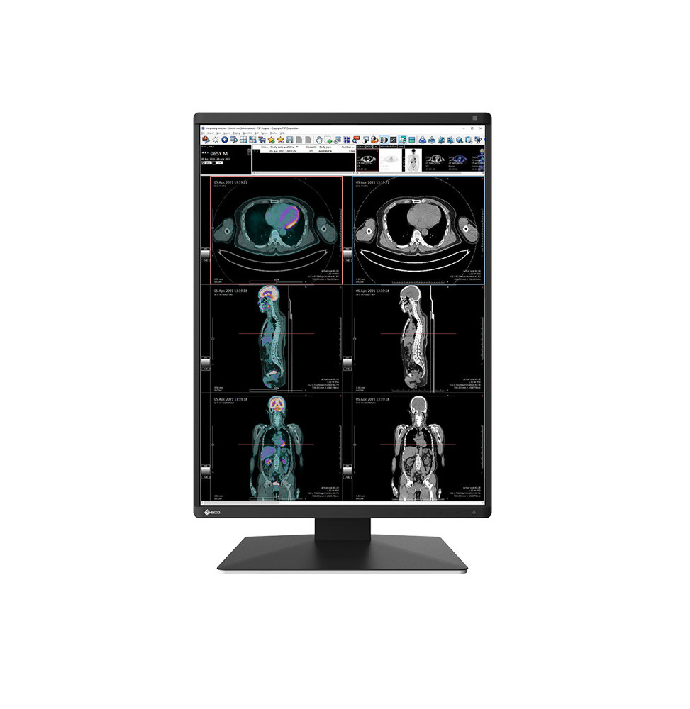 EIZO RadiForce RX370 écran plat de PC 54,1 cm (21.3") 1536 x 2048 pixels LCD Noir (RX370)