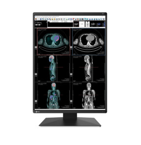 EIZO RadiForce RX370 écran plat de PC 54,1 cm (21.3") 1536 x 2048 pixels LCD Noir (RX370)