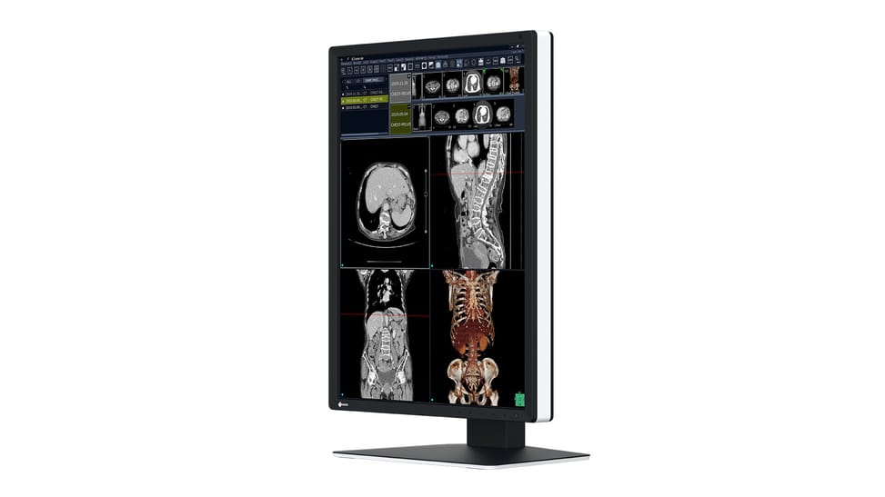 EIZO RadiForce RX270 écran plat de PC 54,1 cm (21.3") 1200 x 1600 pixels UXGA LCD Noir, Blanc (RX270) — image 2