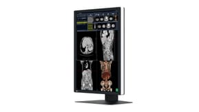 EIZO RadiForce RX270 écran plat de PC 54,1 cm (21.3") 1200 x 1600 pixels UXGA LCD Noir, Blanc (RX270) — image 2