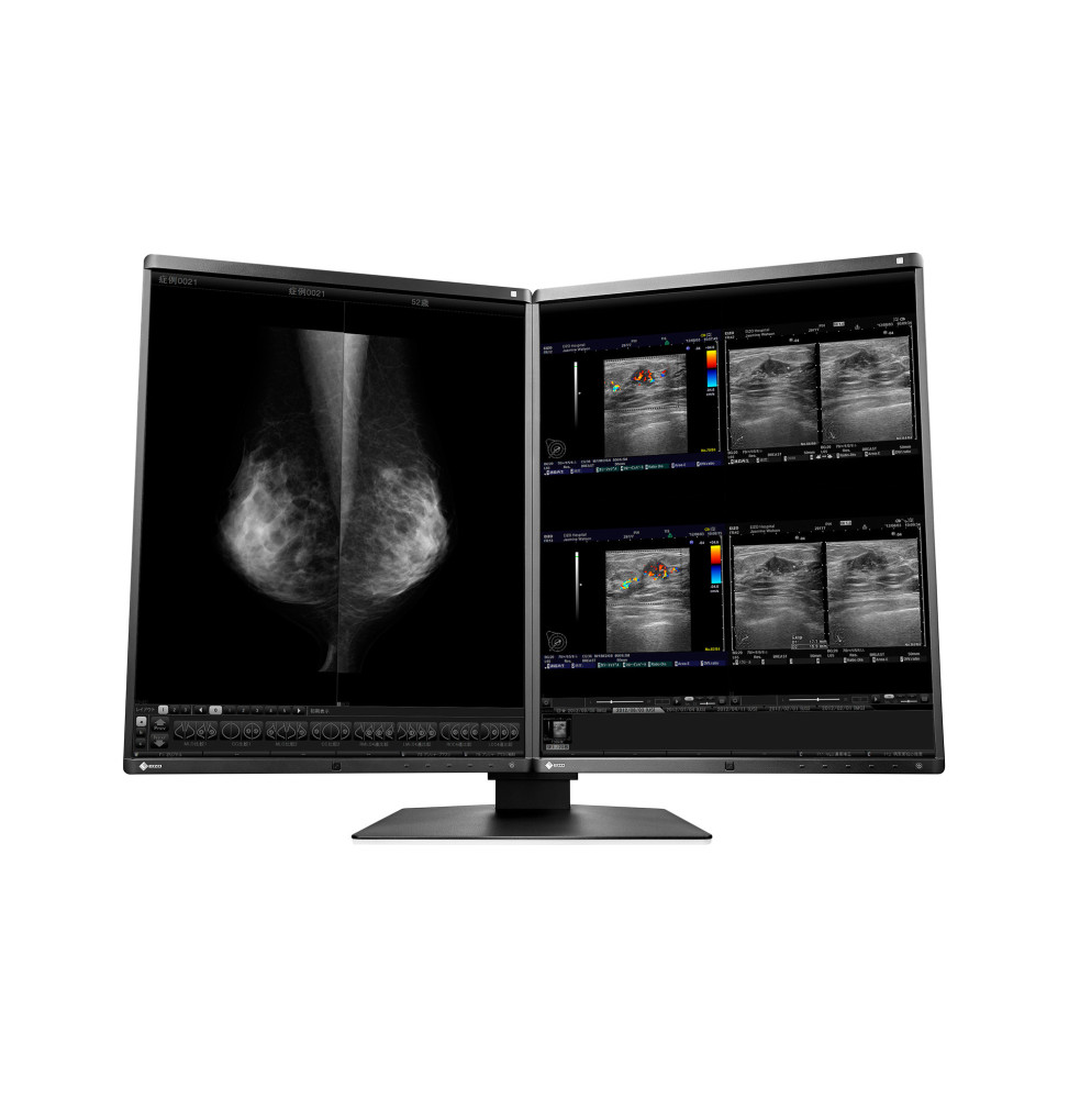 EIZO RadiForce RX560-MD écran plat de PC 54,1 cm (21.3") 2048 x 2560 pixels LCD Noir (RX560-MD)