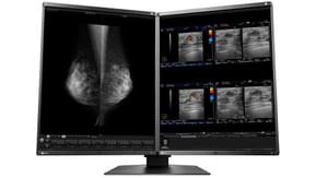 EIZO RadiForce RX560-MD écran plat de PC 54,1 cm (21.3") 2048 x 2560 pixels LCD Noir (RX560-MD)