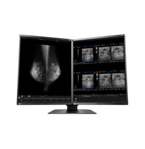 EIZO RadiForce RX560-MD écran plat de PC 54,1 cm (21.3") 2048 x 2560 pixels LCD Noir (RX560-MD)