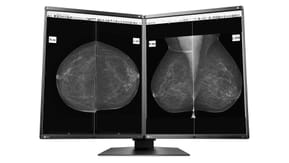 EIZO RadiForce GX560-MD écran plat de PC 54,1 cm (21.3") 2048 x 2560 pixels LCD Noir (GX560MD)