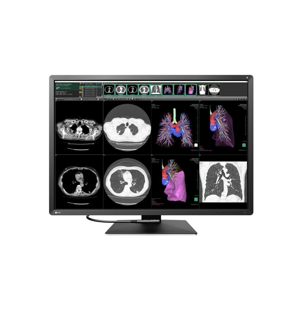 EIZO RadiForce RX1270 écran plat de PC 78,7 cm (31") 4200 x 2800 pixels LCD Noir, Blanc (RX1270)