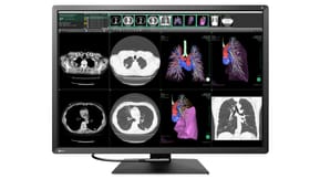 EIZO RadiForce RX1270 écran plat de PC 78,7 cm (31") 4200 x 2800 pixels LCD Noir, Blanc (RX1270)