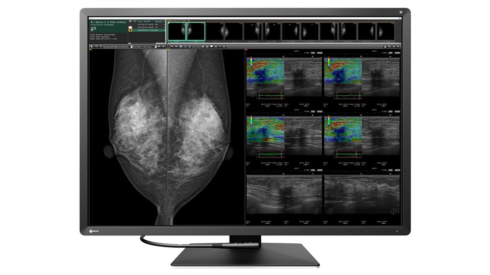 EIZO RadiForce RX1270 écran plat de PC 78,7 cm (31") 4200 x 2800 pixels LCD Noir, Blanc (RX1270) — image 2