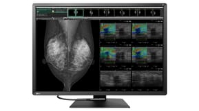 EIZO RadiForce RX1270 écran plat de PC 78,7 cm (31") 4200 x 2800 pixels LCD Noir, Blanc (RX1270) — image 2