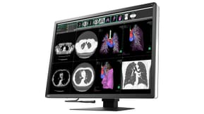 EIZO RadiForce RX1270 écran plat de PC 78,7 cm (31") 4200 x 2800 pixels LCD Noir, Blanc (RX1270) — image 4
