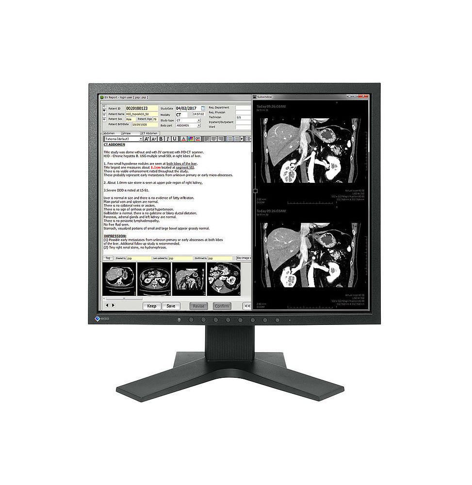 EIZO RadiForce MX194 LED display 48,3 cm (19") 1280 x 1024 pixels LCD Noir (MX194-BK)