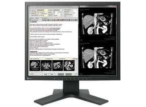 EIZO RadiForce MX194 LED display 48,3 cm (19") 1280 x 1024 pixels LCD Noir (MX194-BK)