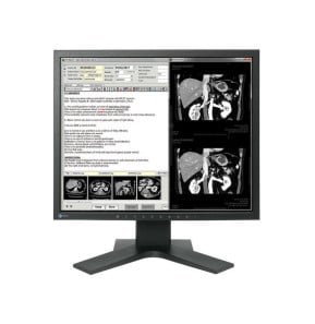 EIZO RadiForce MX194 LED display 48,3 cm (19") 1280 x 1024 pixels LCD Noir (MX194-BK)
