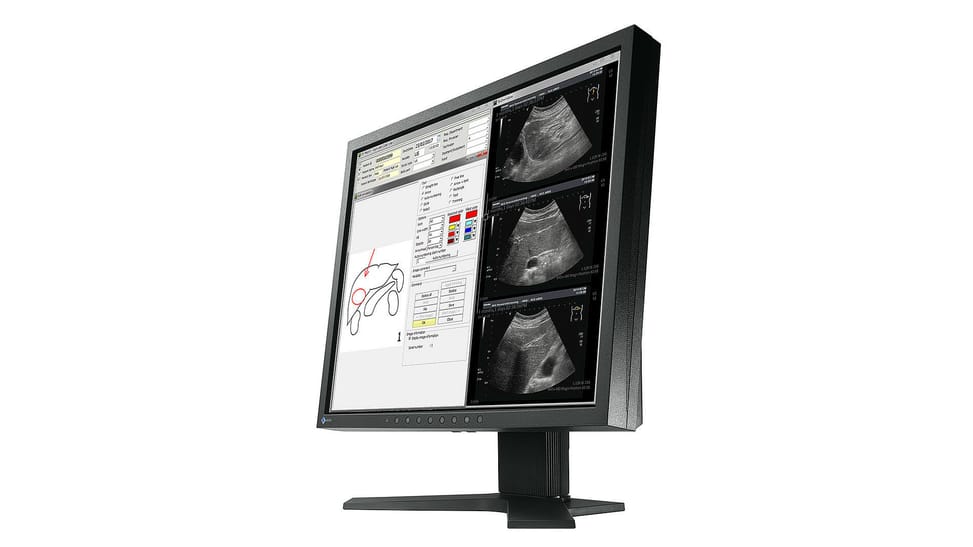 EIZO RadiForce MX194 LED display 48,3 cm (19") 1280 x 1024 pixels LCD Noir (MX194-BK) — image 3