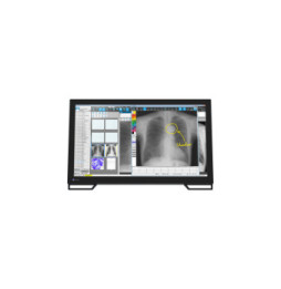 EIZO RadiForce MS236WT écran plat de PC 58,4 cm (23") 1920 x 1080 pixels Full HD LCD Écran tactile Dessus de table Noir