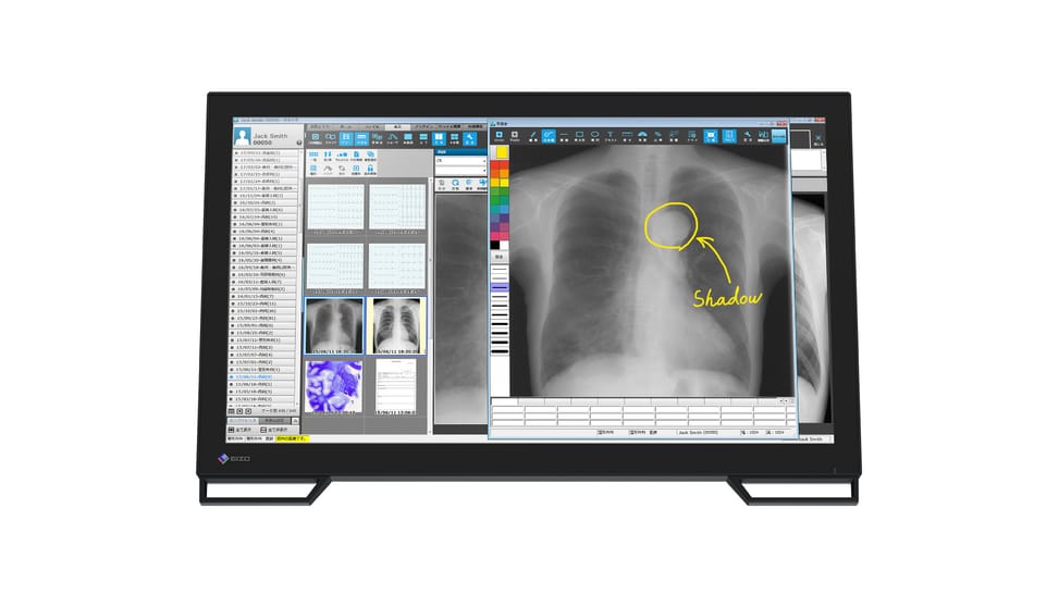 EIZO RadiForce MS236WT écran plat de PC 58,4 cm (23") 1920 x 1080 pixels Full HD LCD Écran tactile Dessus de table Noir — image 9