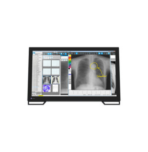 EIZO RadiForce MS236WT écran plat de PC 58,4 cm (23") 1920 x 1080 pixels Full HD LCD Écran tactile Dessus de table Noir
