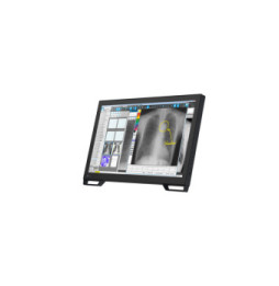 EIZO RadiForce MS236WT écran plat de PC 58,4 cm (23") 1920 x 1080 pixels Full HD LCD Écran tactile Dessus de table Noir