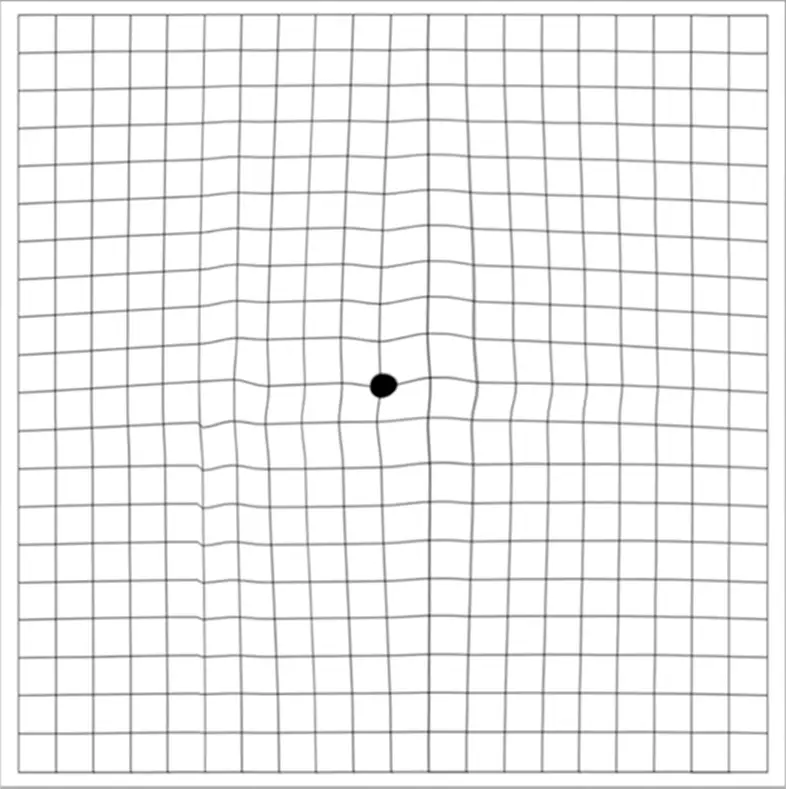 Amsler Grid