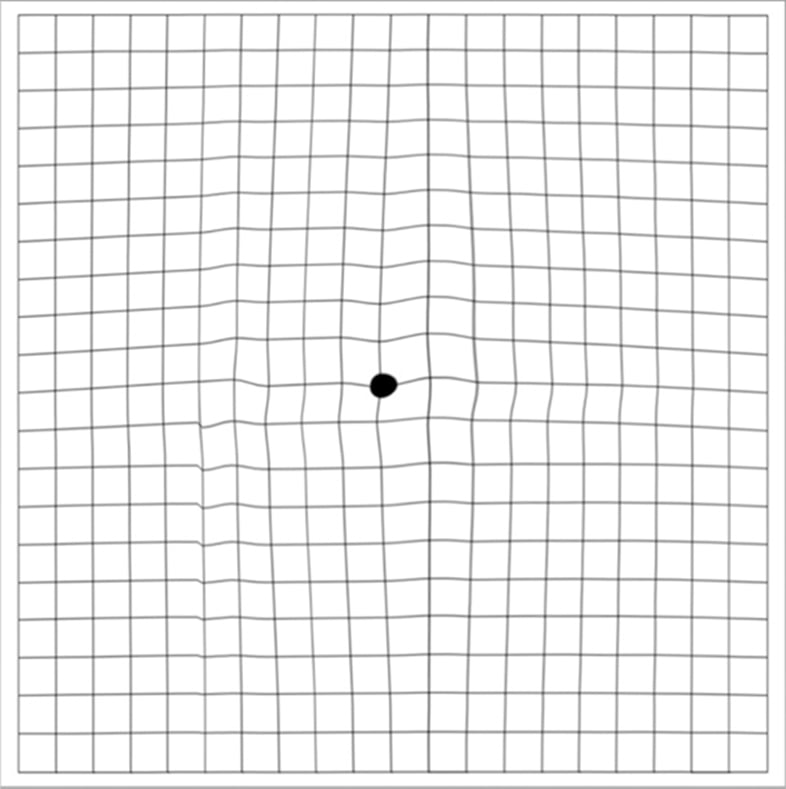 Amsler Grid